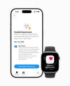 Apple Watch Series 11, Ultra 3, SE: Specs, Price, Release Date