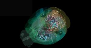 This Is the First Time Scientists Have Seen Decisionmaking in a Brain